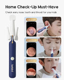 Smart Ear Wax Remover – 1080p Camera for Safe Cleaning